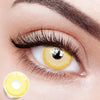 Yellow Sunbeam Eyes | 1 Year