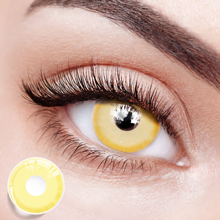 Yellow Sunbeam Eyes | 1 Year