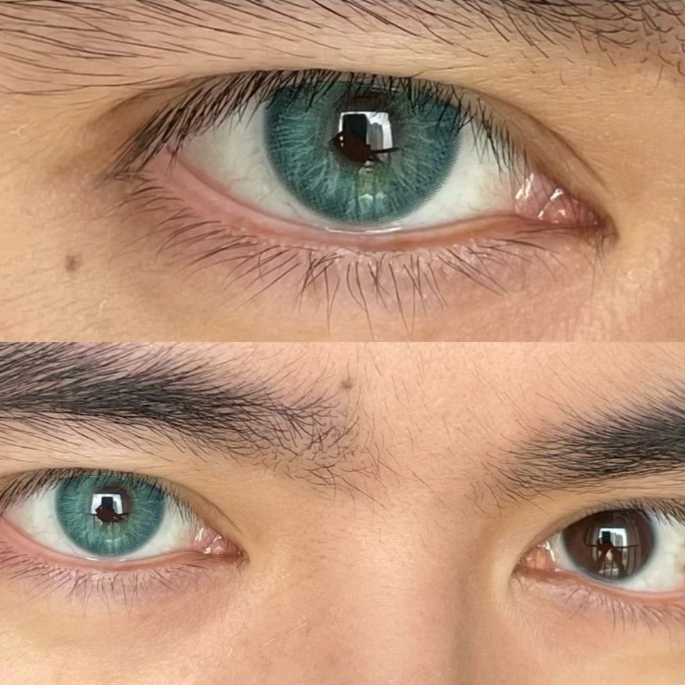 Forest Spark Green Ⅱ | 6 Months