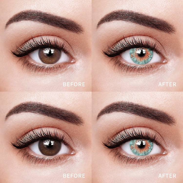 Micro Green | 1 Year