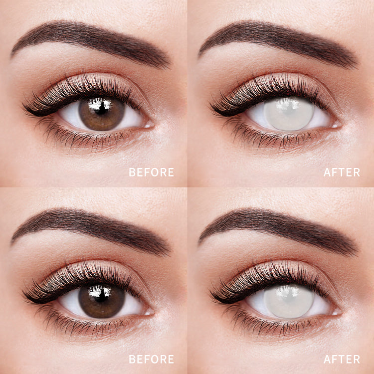 Pure White Vision | 1 Year