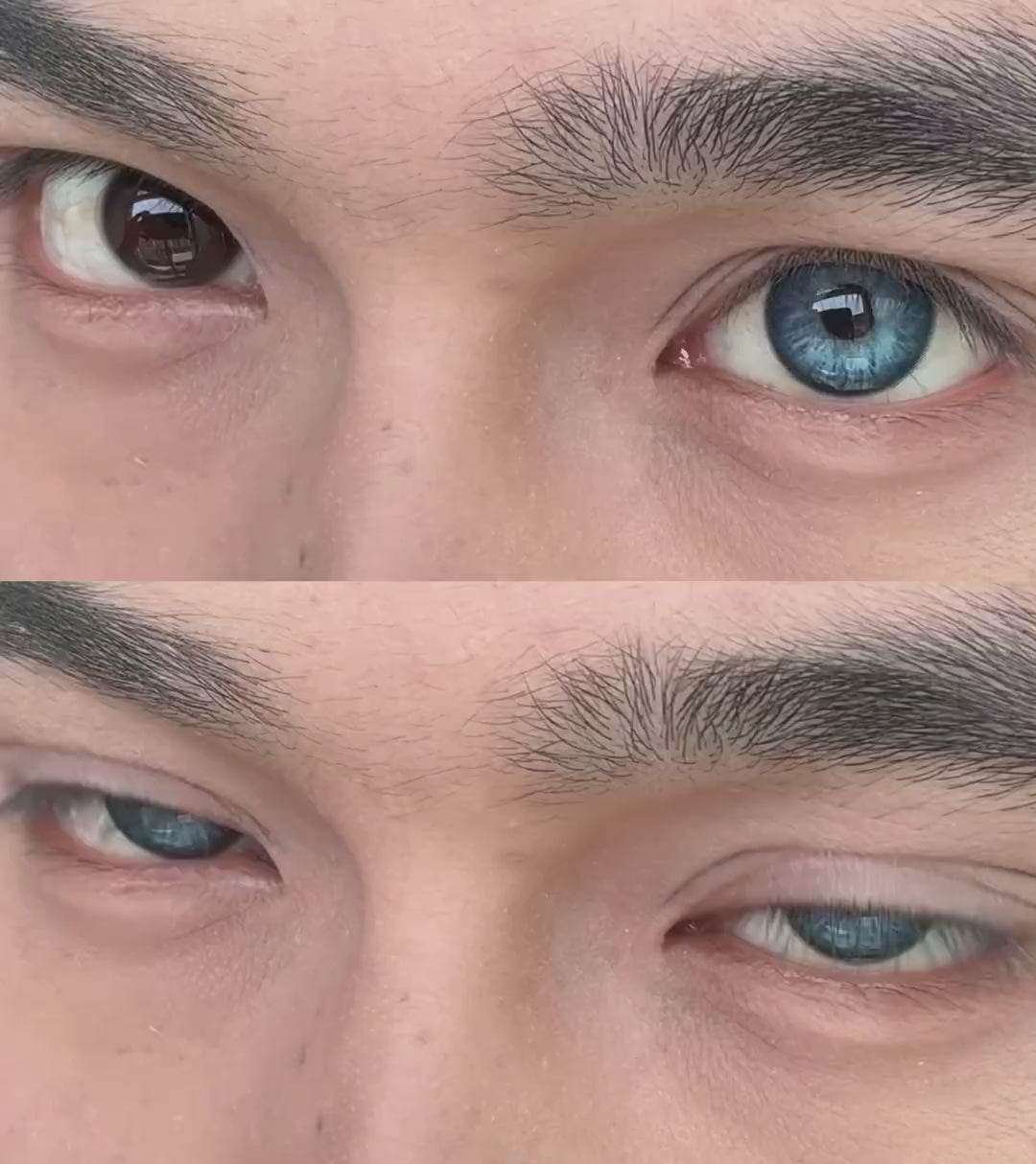 Stormy Blue Ⅱ | 1 Year